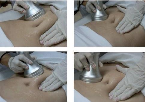 Lipocavitation cellulite jardin de la beaute 1